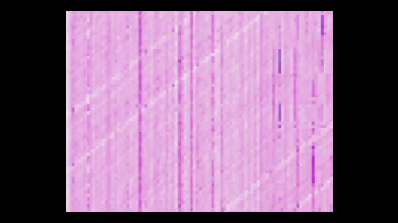 INSANE ANALOG VIDEO FEEDBACK _ BPMC FLUXUS DUO + BPMC TOUCH AVE3