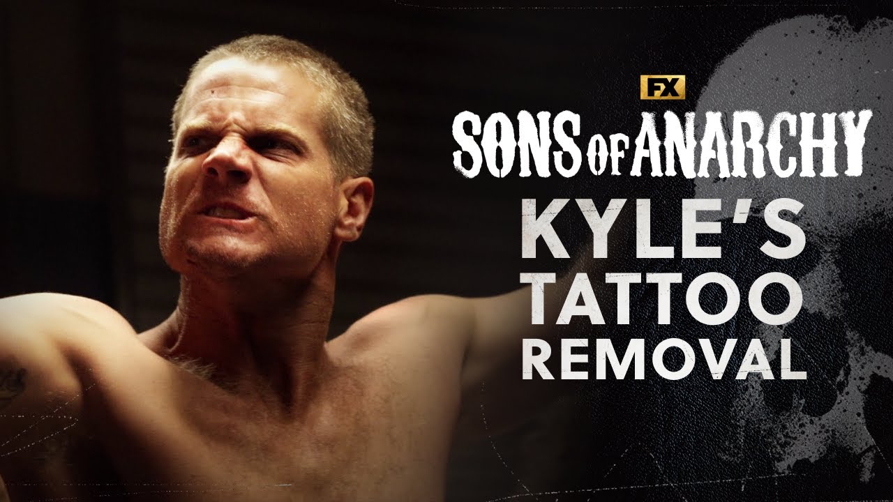 Kyle's Tattoo is Removed - Scene | Sons Of Anarchy | FX