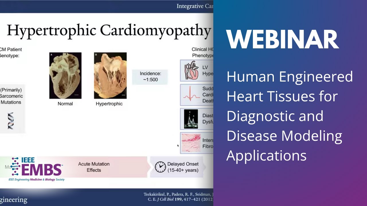 Therapeutic & Diagnostic Systems and Technologies Webinar Series | Stuart Campbell, Yale | IEEE EMBS
