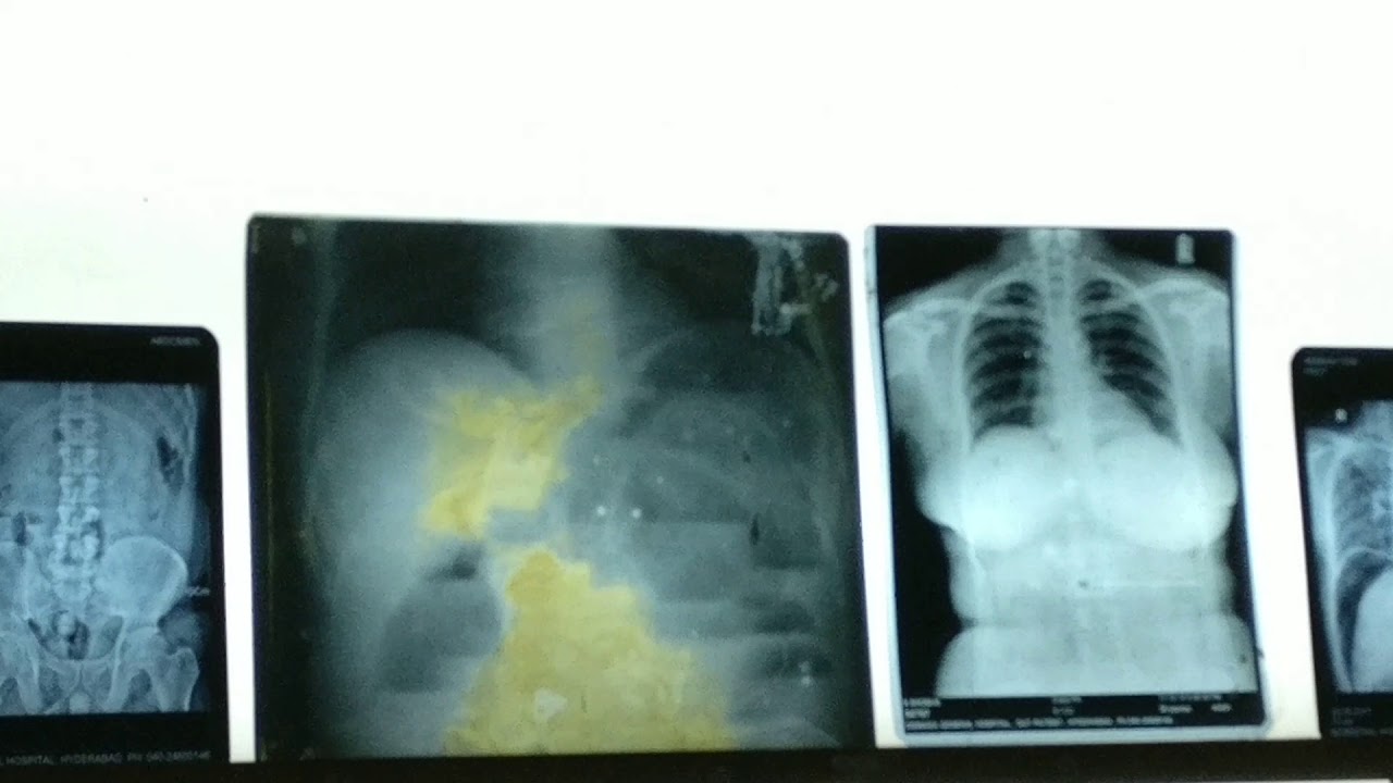 X-Rays for Surgery Practicals