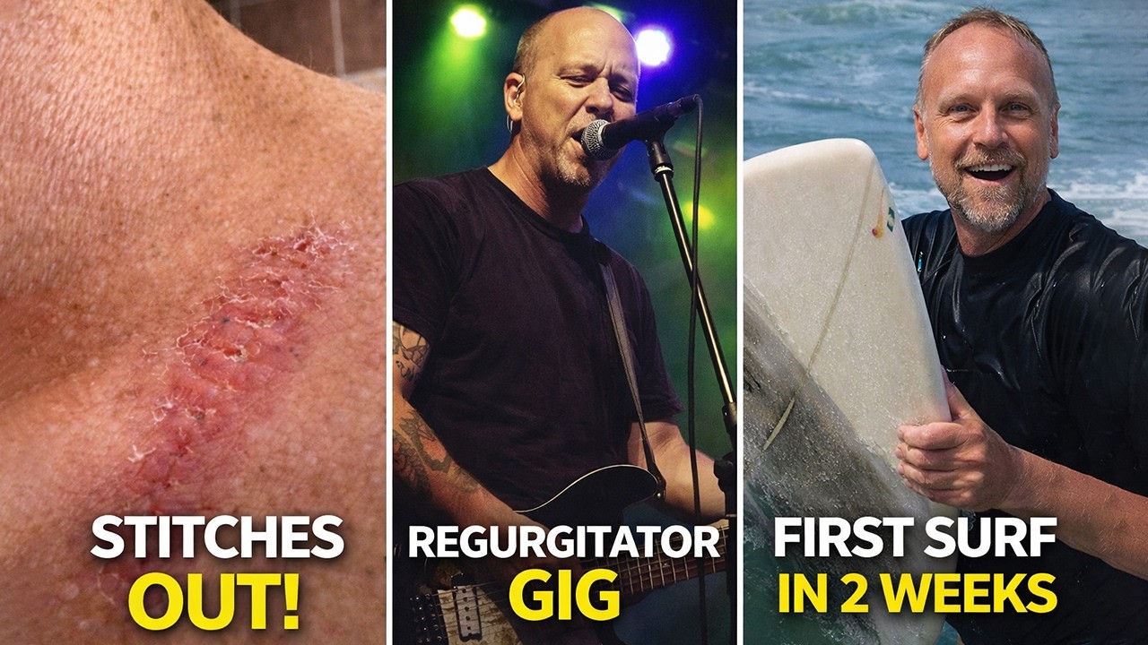 Post-Stitches Life Update: Shooting Regurgitator + First Surf Back