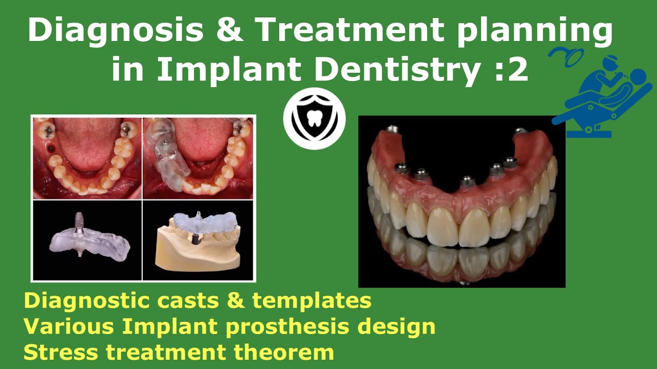 Diagnosis & Treatment Planning in Implant Dentistry: part 2