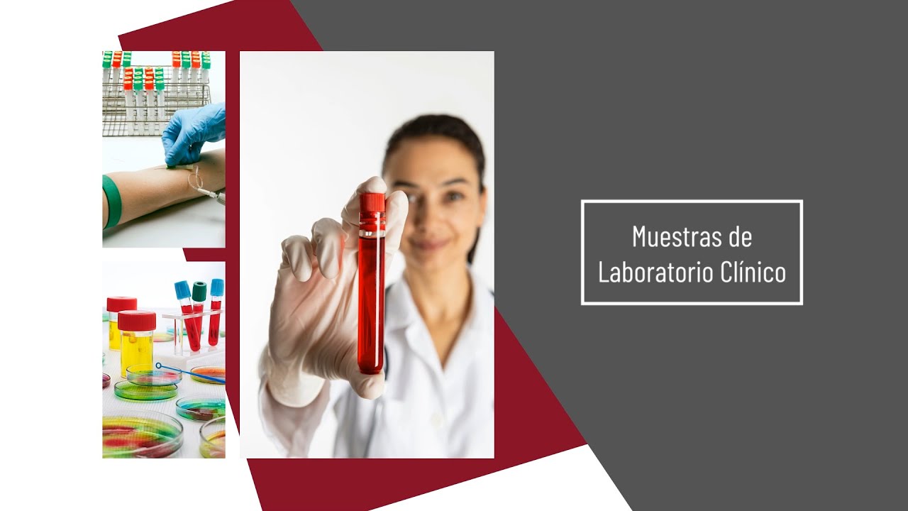 Muestras de Laboratorio Cl&iacute;nico