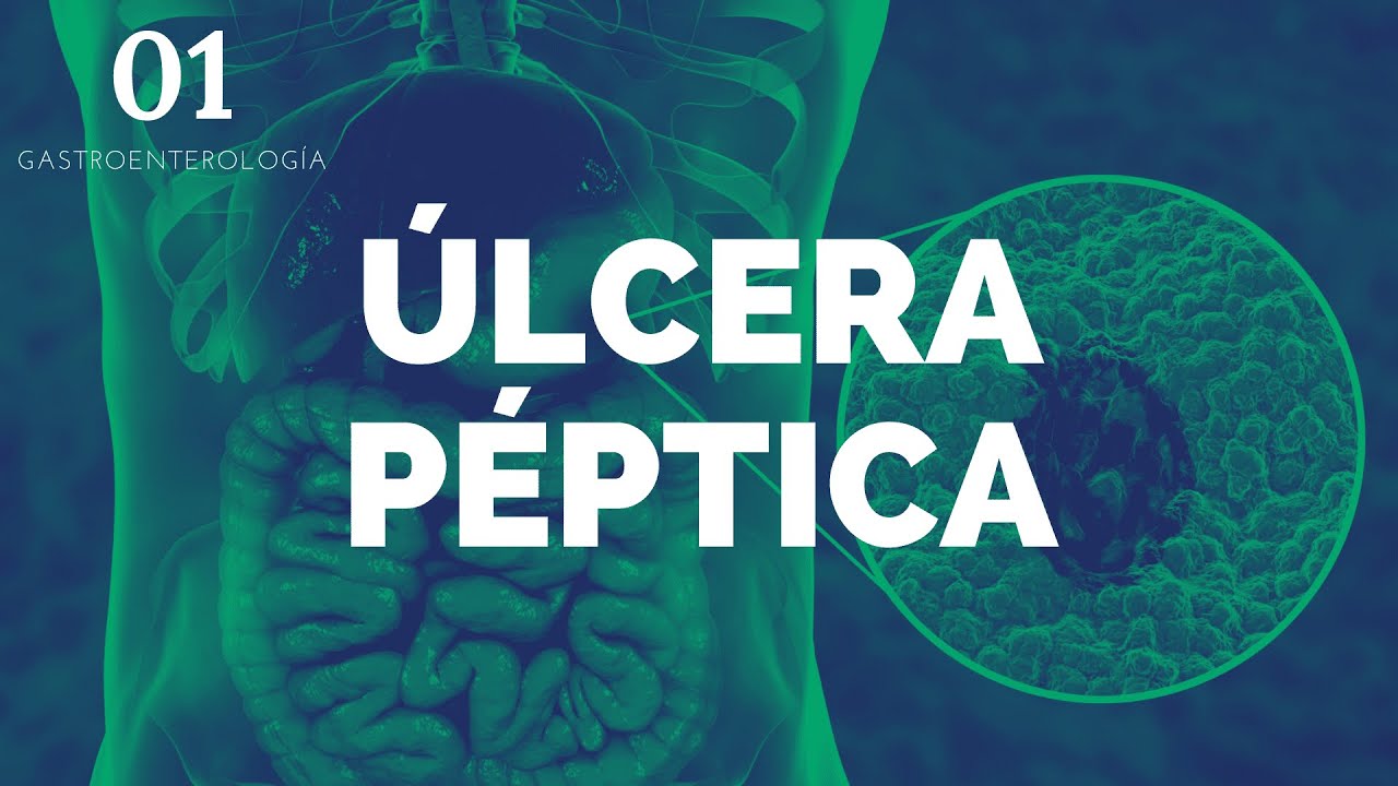 Úlcera péptica - ENARM