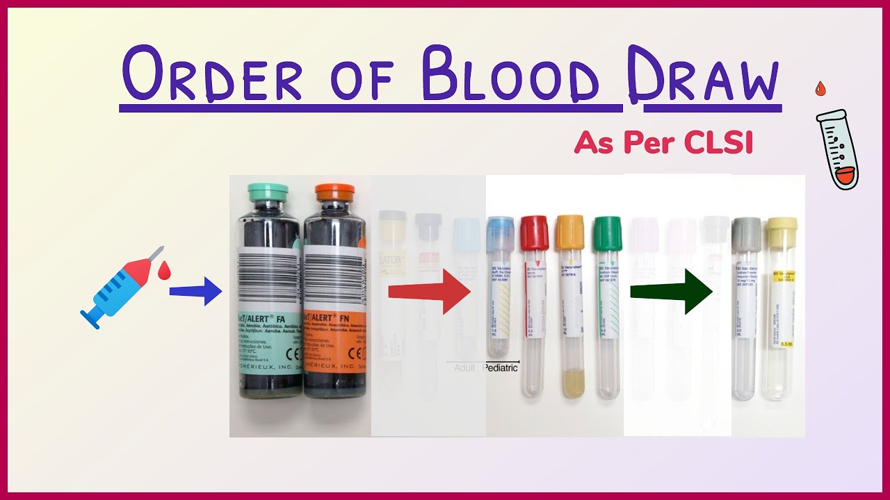 Order of Draw in Phlebotomy | Recommended by CLSI | In Hindi | By Madhukar Sir