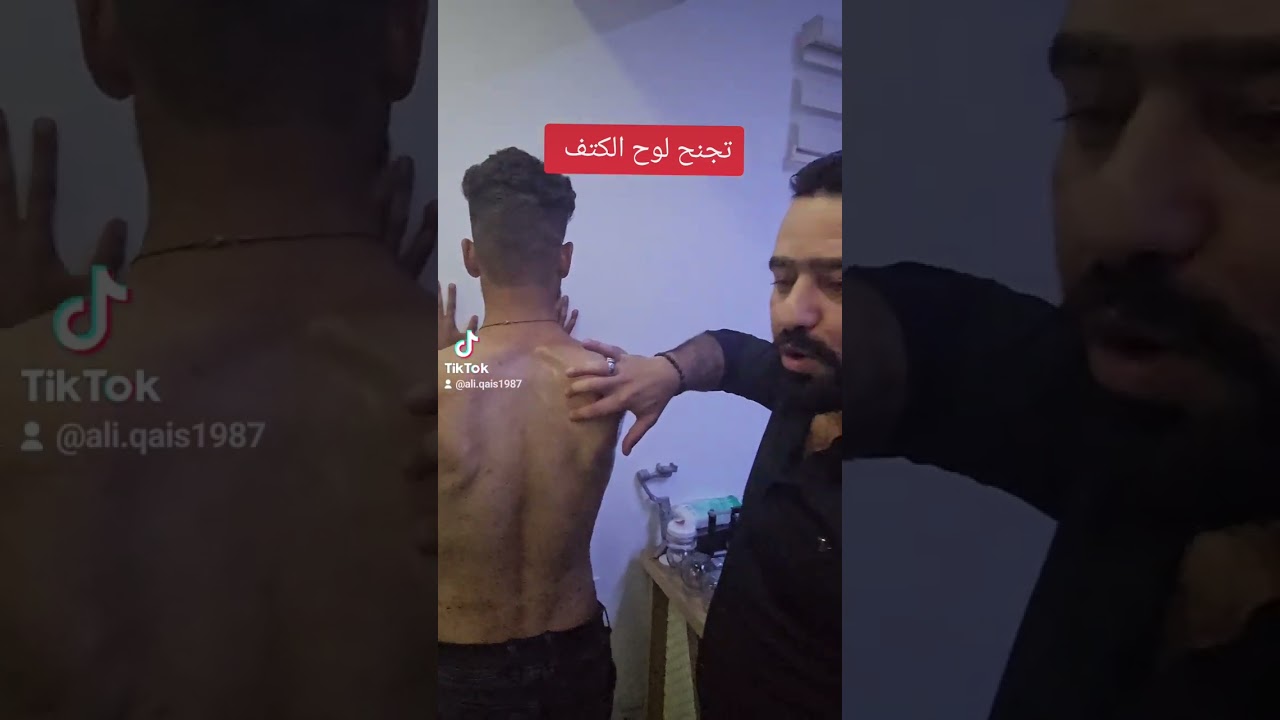 علاج تجنح لوح الكتف