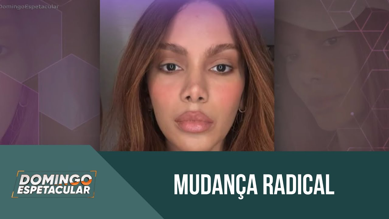 Anitta surpreende ao aparecer nas redes sociais com rosto diferente