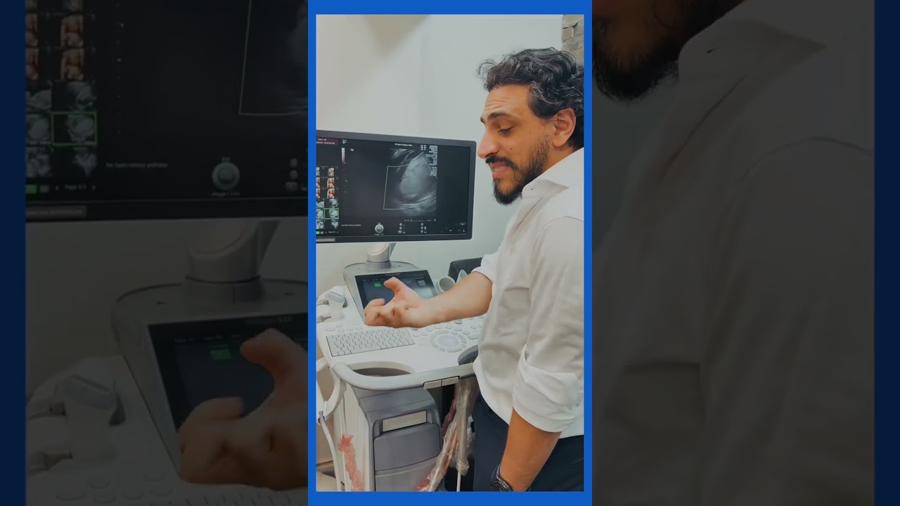 مخاطر انفصال المشيمه والتجمع الدموي اثناء الحمل