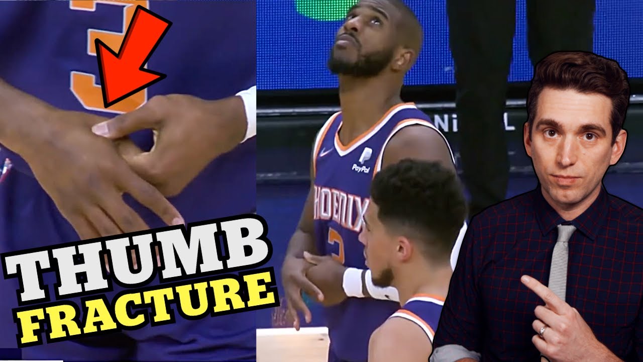 Chris Paul FRACTURED His Thumb - Doctor Explains Surprising NBA Injury