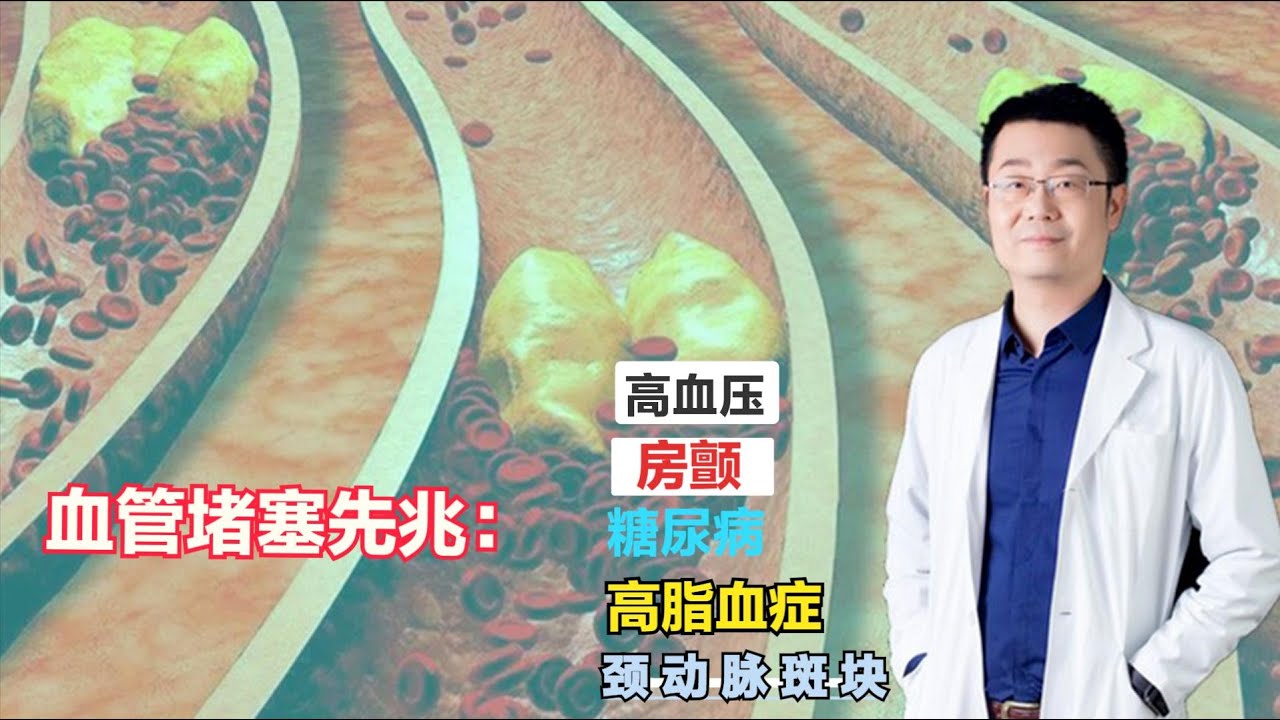 脑血管堵塞，会有哪些先兆？医生提醒：这5个病都是先兆！ #张之瀛大夫 #张之瀛