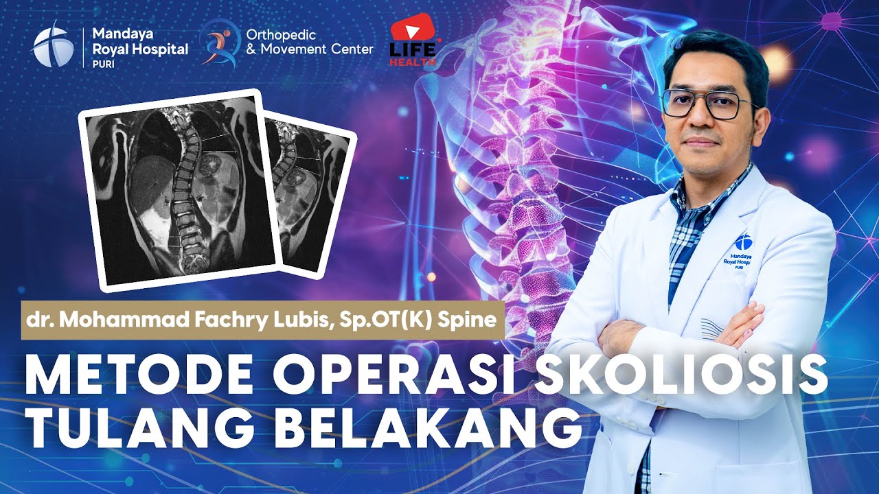 Penanganan Skoliosis oleh dokter Spesialis Tulang Belakang | dr. M. Fachry Lubis, Sp.OT(K) Spine