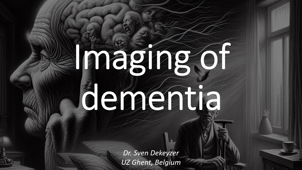 When is it dementia? Imaging in dementia from A(lzheimer) to (Creut)Z(feldt-Jakob).