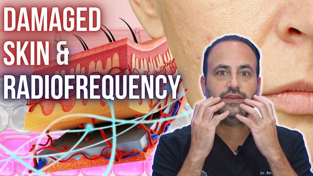 Damaged Skin & Radiofrequency | Dr. Ben Talei | Plastic Surgeon in Beverly Hills