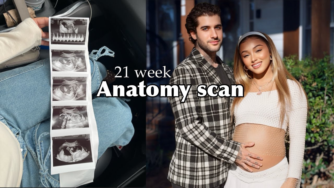 OUR 21 WEEK ANATOMY SCAN *EMOTIONAL*