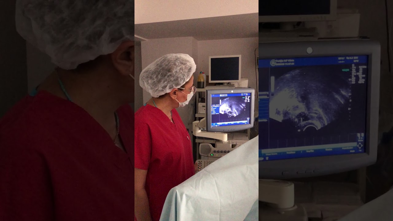 #TüpBebek Tedavisinde #PRP Yöntemi - Dr. Seval Taşdemir