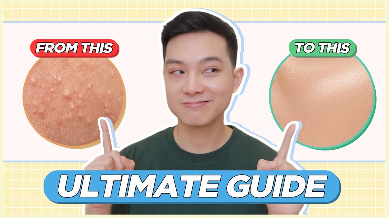ULTIMATE GUIDE to Treat & Prevent BLACKHEADS, WHITEHEADS, TINY BUMPS for FILIPINO SKIN! | Jan Angelo