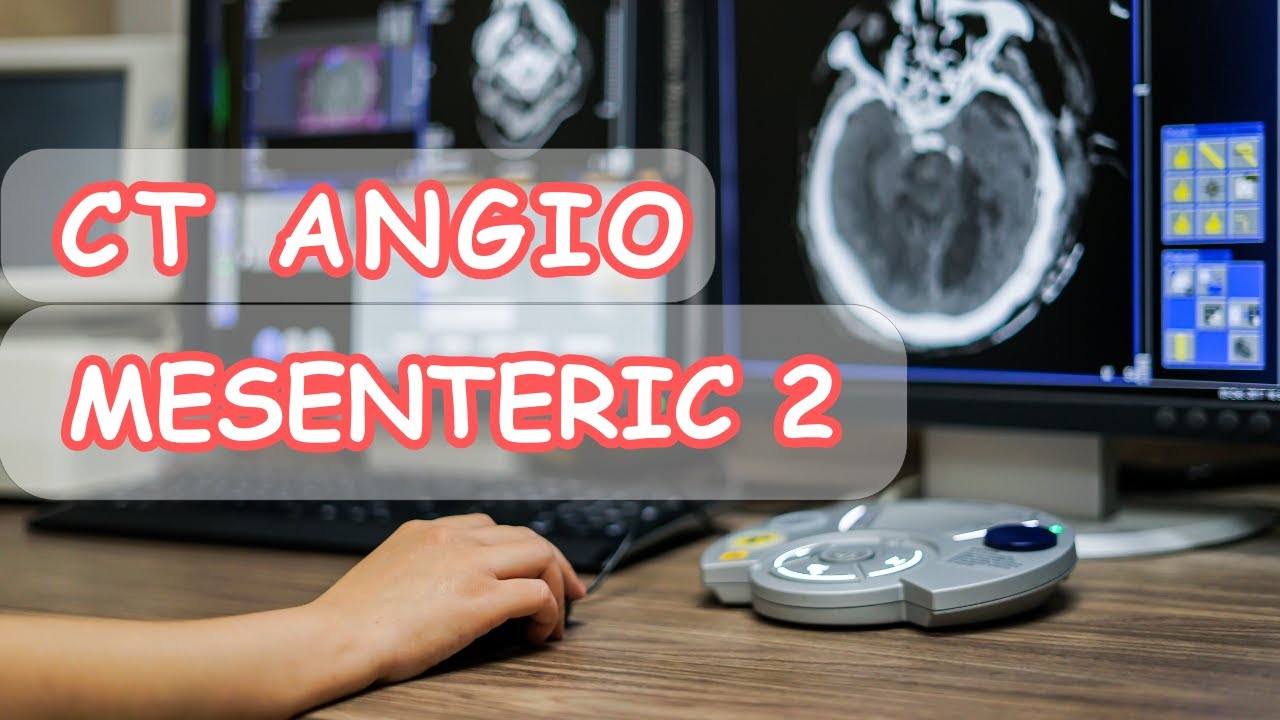 Ct angio mesenteric reconstructionتقطيع و اعادة بناء الصور لشرايين الأمعاء