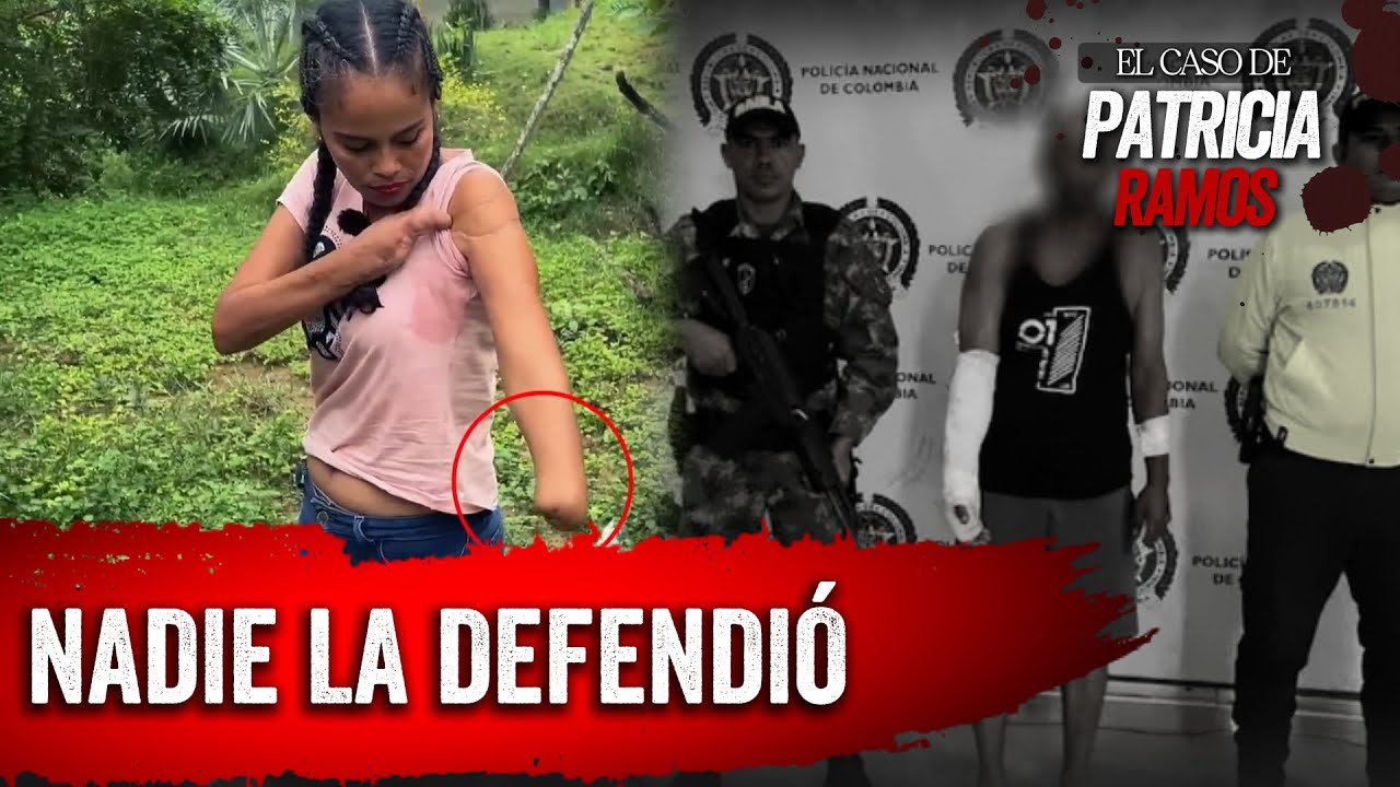 Sobrevivi&oacute; al At@qu3 de su ex pareja: el caso de Patricia