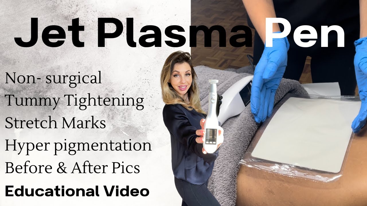 Jet Plasma Treatment- Tummy Tightening, Pigmentation, Stretch-marks  with no downtime
