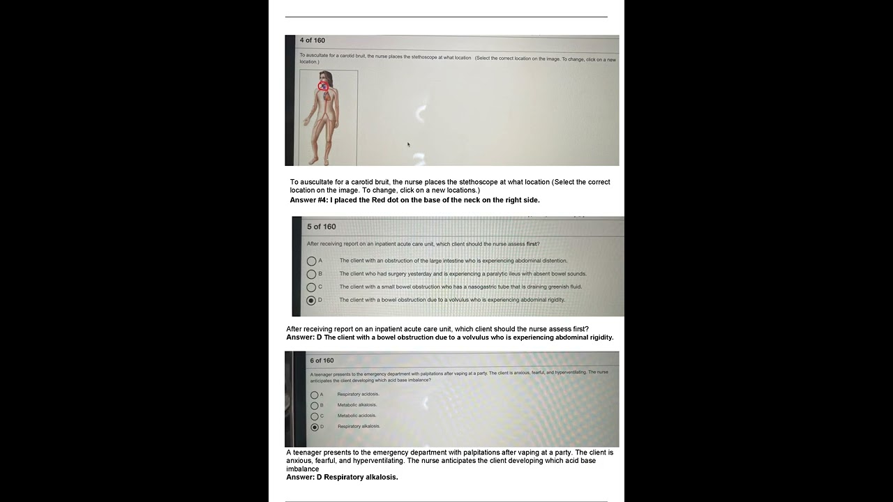 2022 RN HESI EXIT EXAM   Version 1 V1 All 160 Que+Ans Included  Already Graded A+