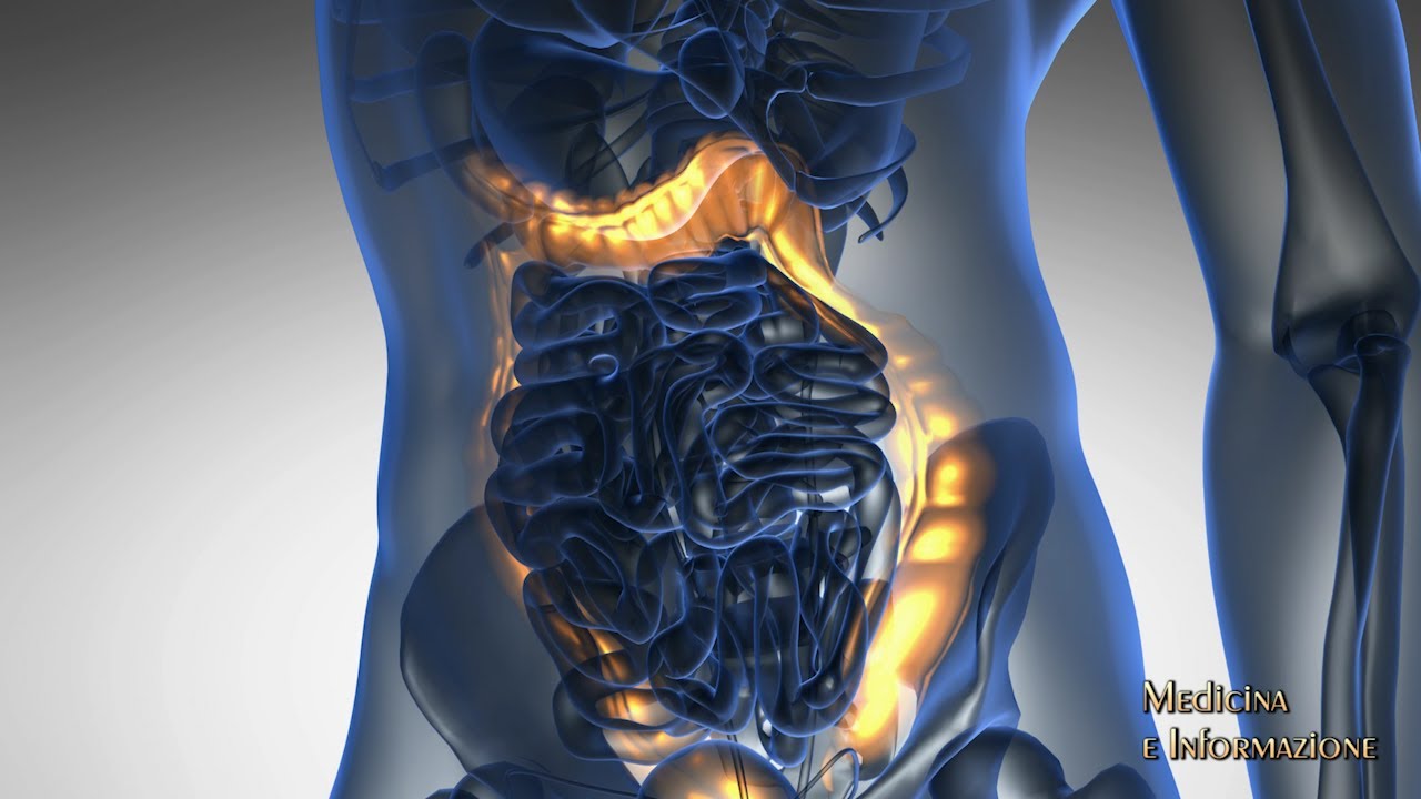 Malattia di Crohn e Rettocolite Ulcerosa: il ruolo dei farmaci biologici nel controllo di malattia
