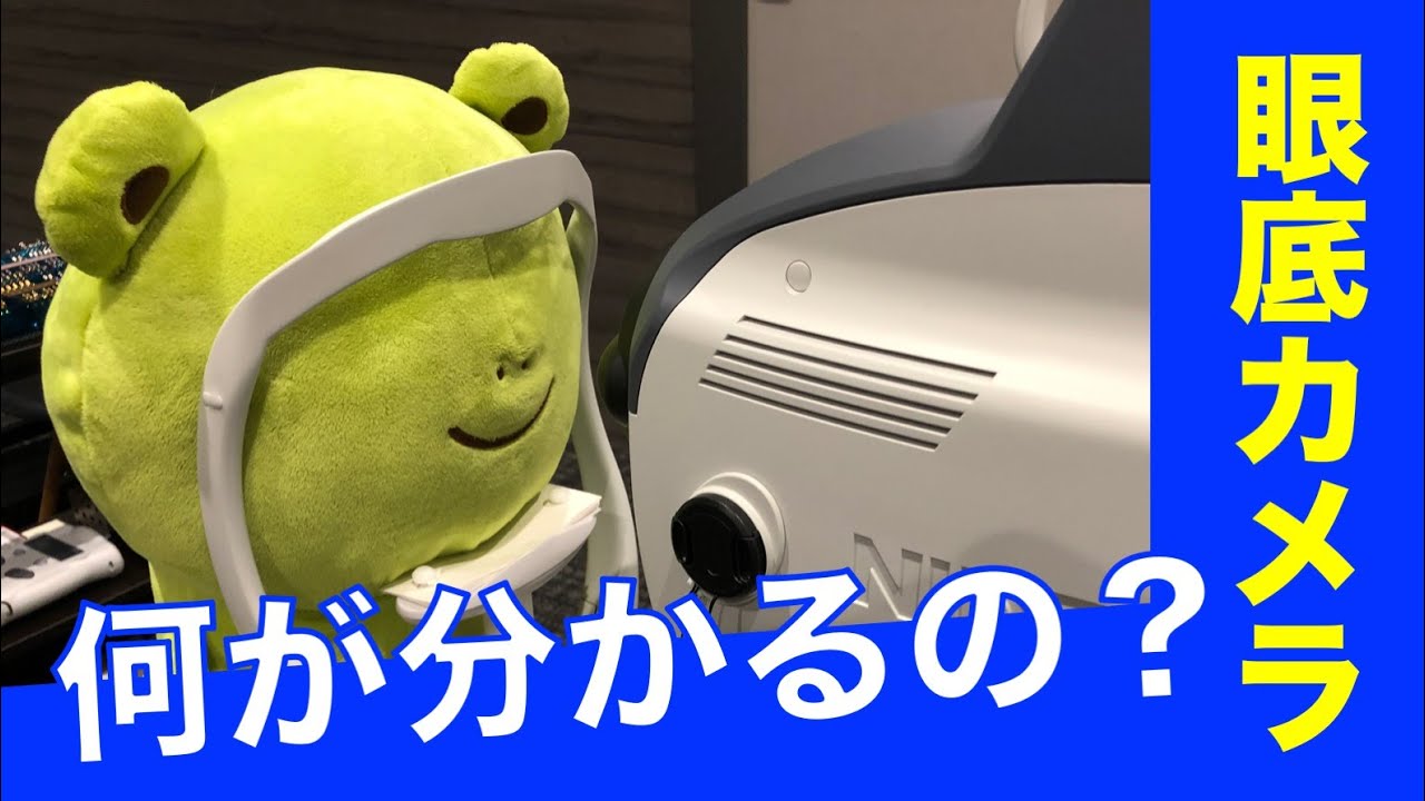 人間ドックの目の検査。どこまで分かる？【眼底カメラ】