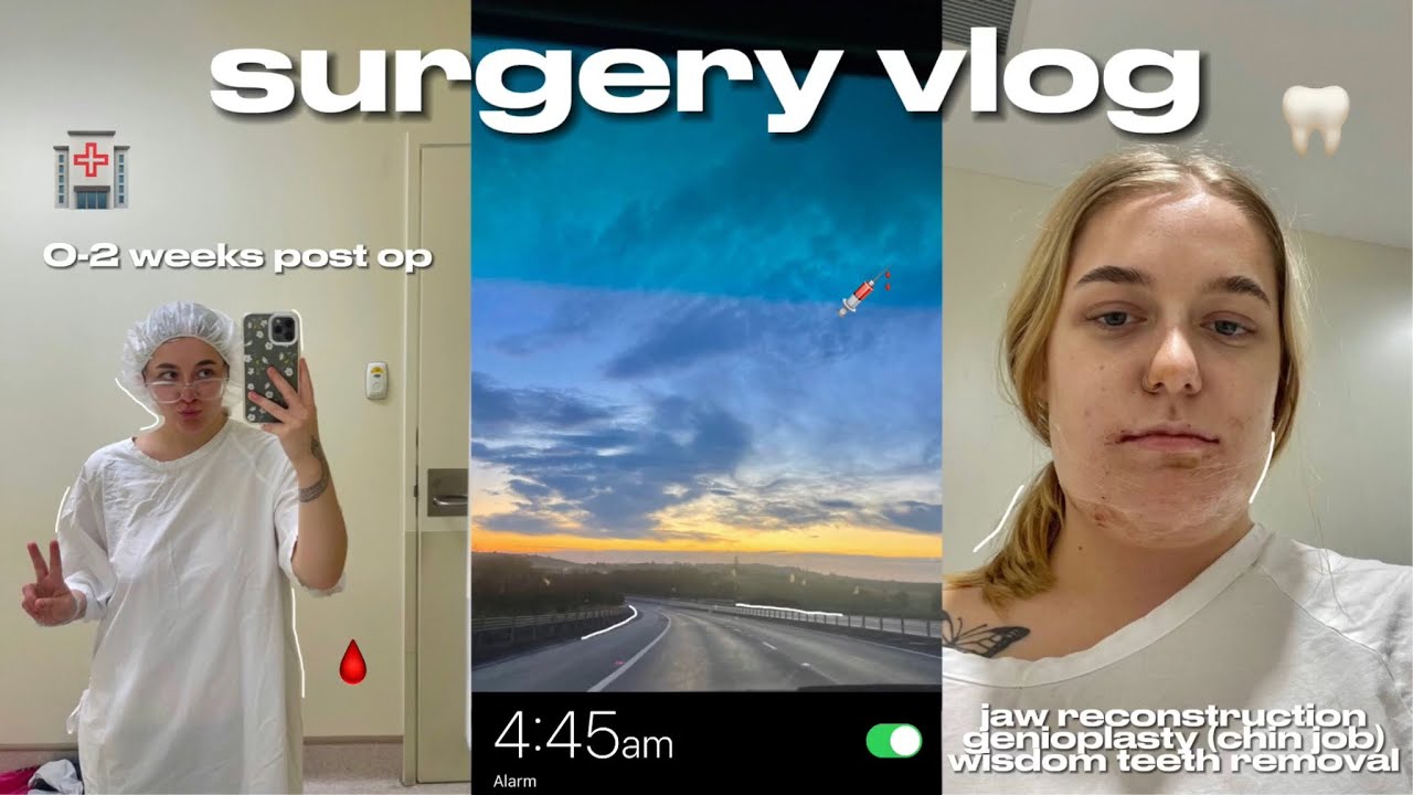 Мне сделали операцию! 🦷 челюстно-лицевая хирургия + гениопластика 🏥 Восстановление 0-2 недели