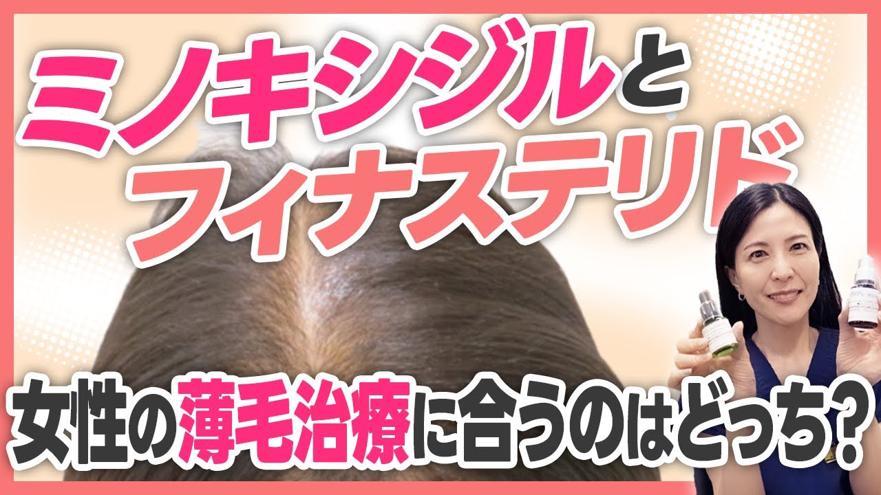 【専門医が解説】ミノキシジルとフィナステリド、女性の薄毛治療に合うのはどっち？
