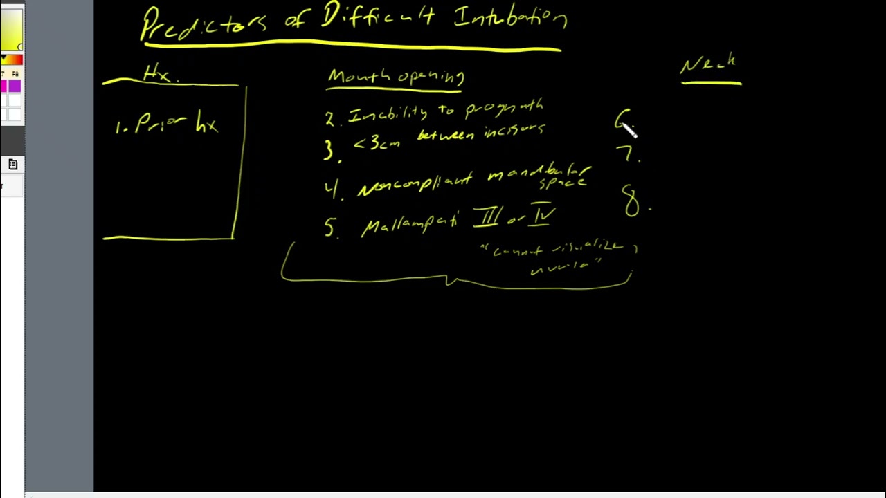 Predictors of Difficult Intubation