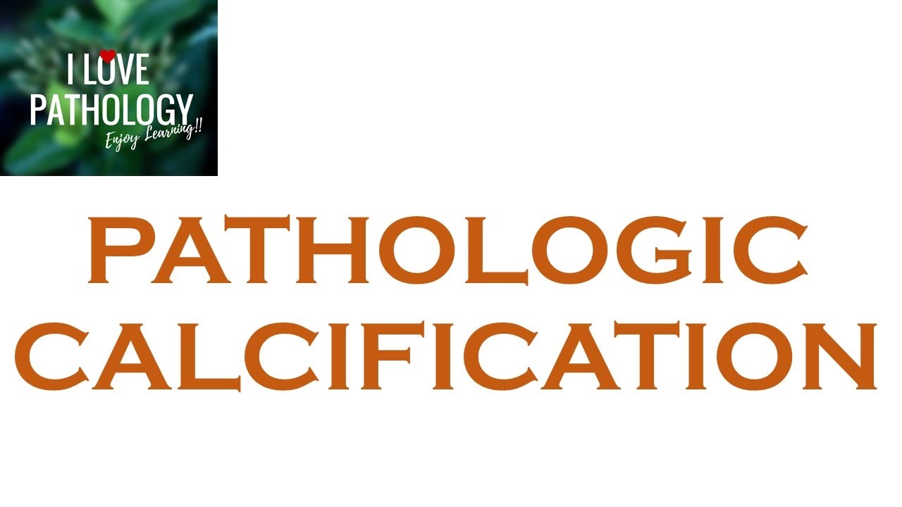 PATHOLOGIC CALCIFICATION: Dystrophic & Metastatic Calcification