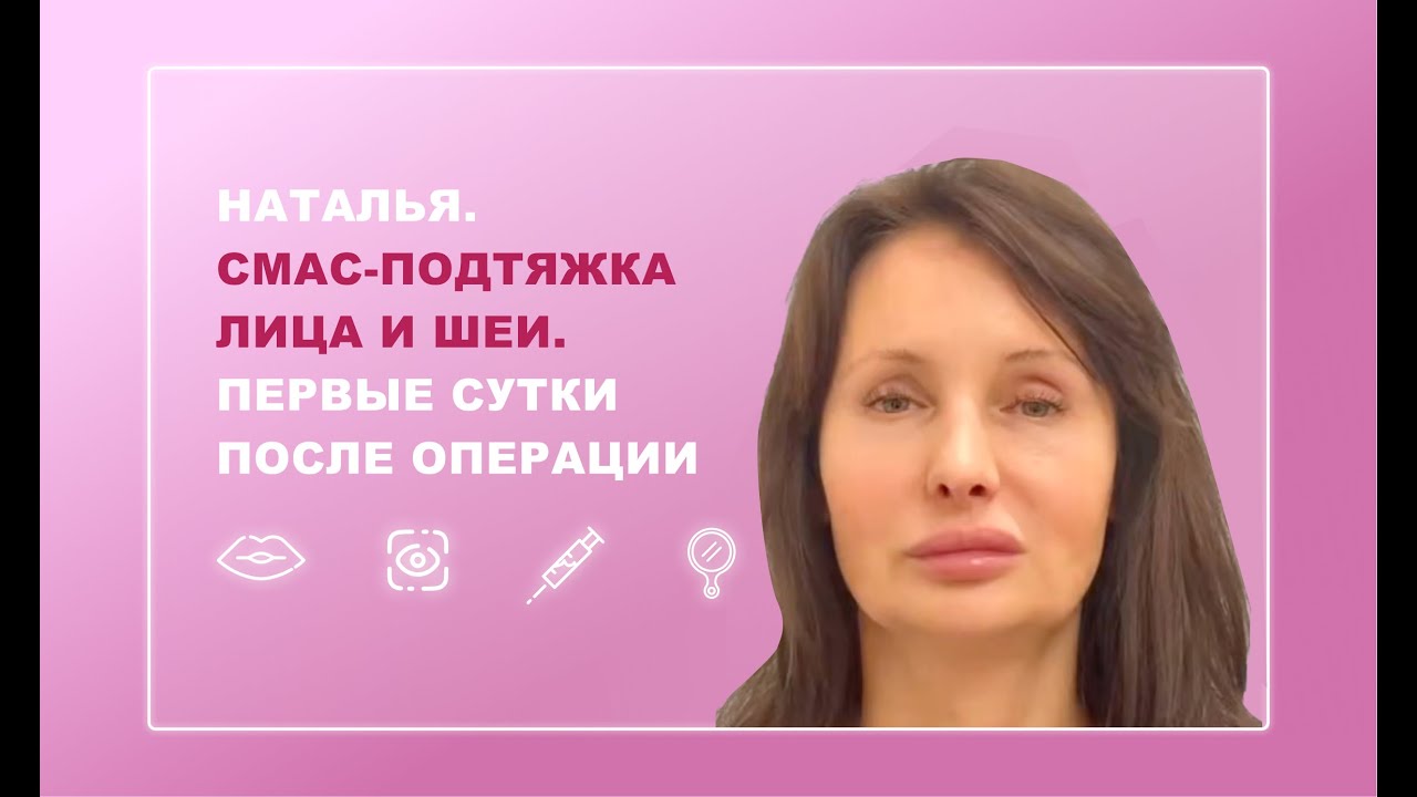Наталья. СМАС-подтяжка лица и шеи. Первые сутки после операции