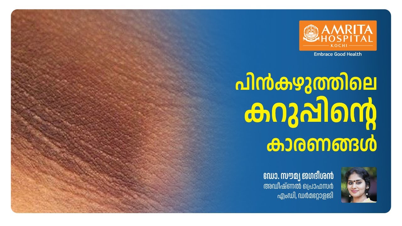 കഴുത്തിലെ കറുത്ത നിറം എന്തുകൊണ്ട്? | Amrita Hospital Kochi