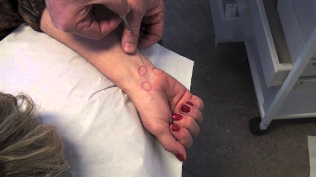 Injectie Carpale Tunnel Dr. Jan Mens