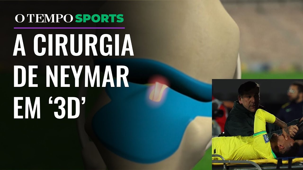 Neymar: Entenda lesão e cirurgia feita pelo atacante em Belo Horizonte