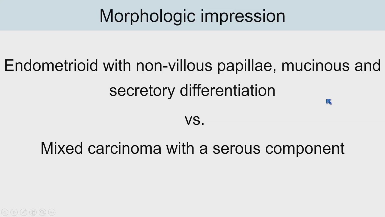Surgical Pathology Update: Diagnostic Pearls for the Practicing Pathologist, Vol. IV
