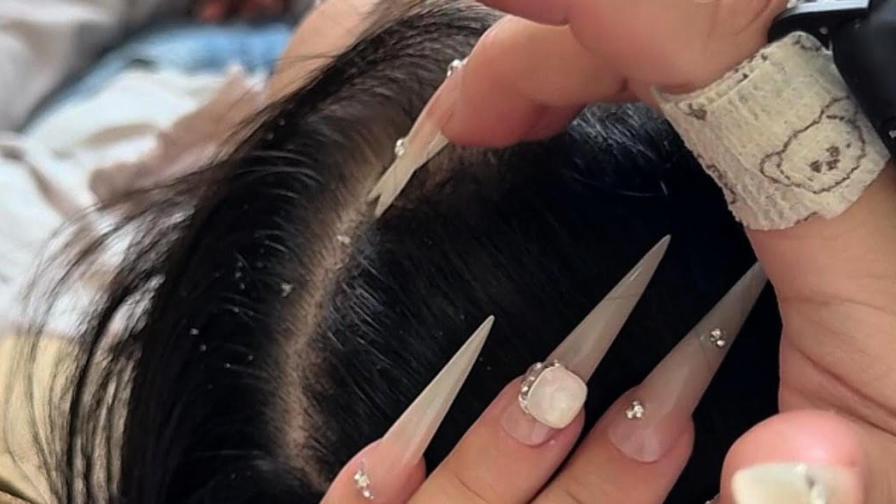 ASMR Scalp Marathon: Long Nails Scraping Flakes & Dandruff Removal