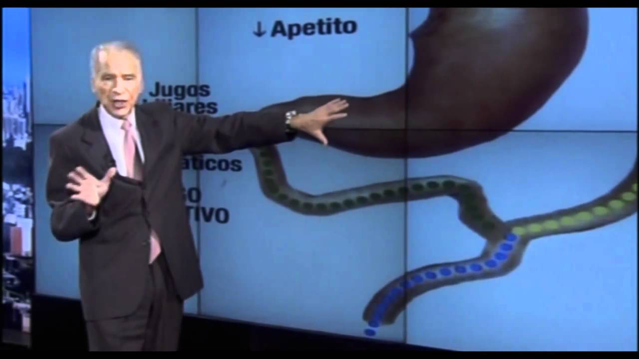 Dr. Cormillot | Cirugias Obesidad