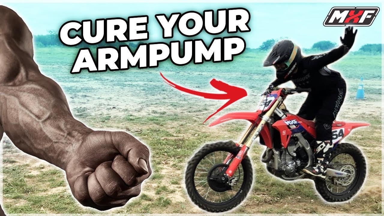 3 Drills to Prevent Arm Pump | Dirt Bike Tips