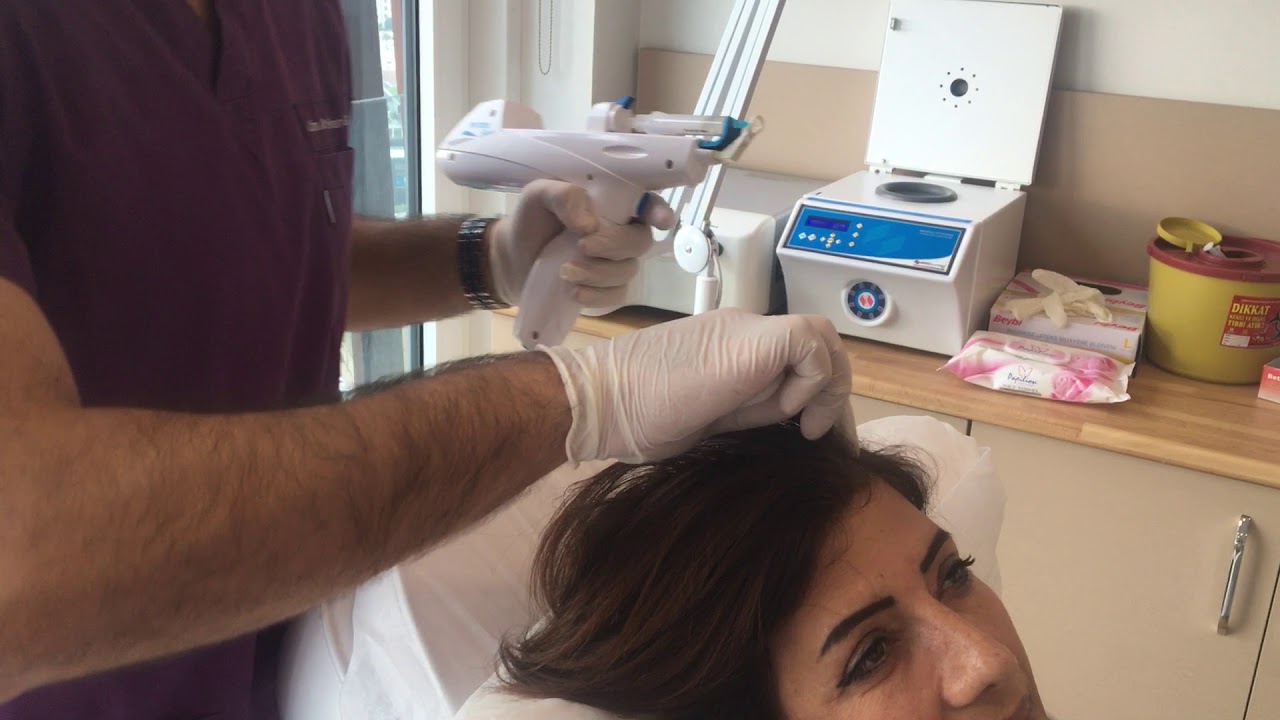 Dökülen Saçlar İçin Saç Mezoterapisi! Uzm. Dr. Evren Gökeşme