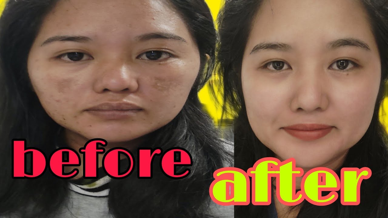 PEKAS NO MORE I MAINTENANCE I PARA DINA BUMALIK #pekas #beautytips #greentea