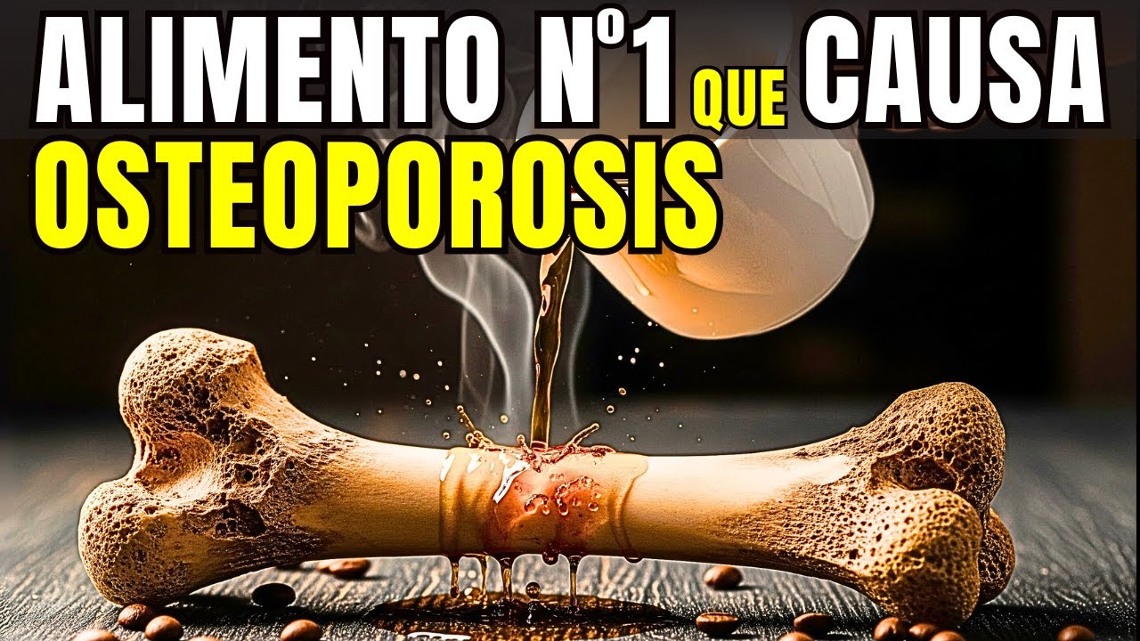 ALIMENTO #1 que DESTRUYE tus HUESOS y Causa Osteoporosis