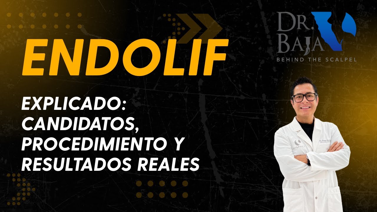 Endolift explicado: candidatos, procedimiento y resultados reales