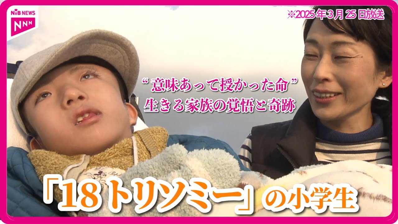 【特集】生後1年の生存率は1割「18トリソミー」“意味あって授かった命”と生きる家族の覚悟と奇跡