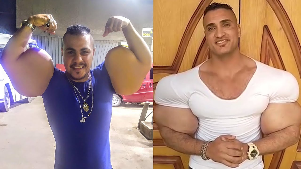 Biggest Synthol Freaks Of 2023 | Best Oil Guys Of 2023 #24