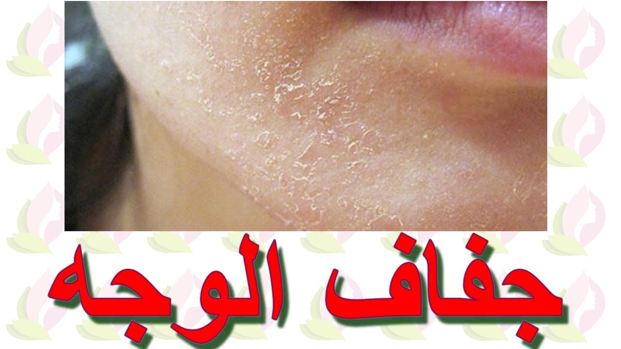 ما هو علاج جفاف الوجه
