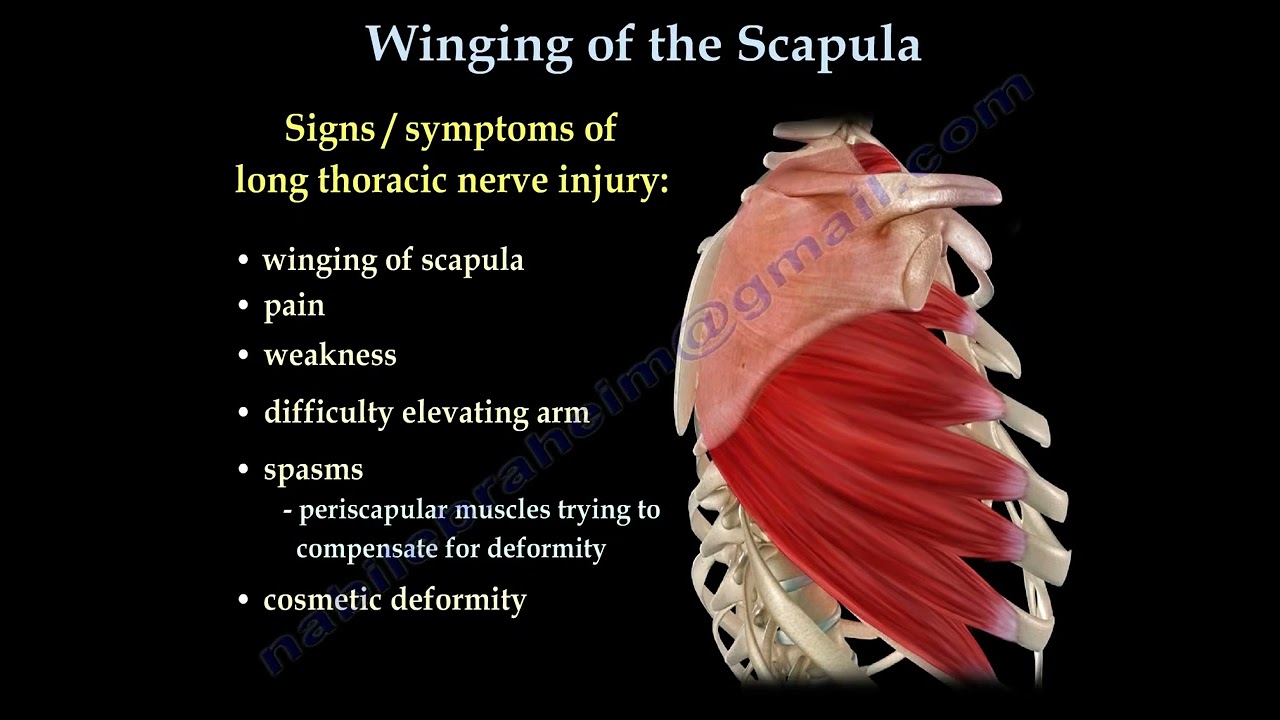 Medial Scapular Winging: Causes, Symptoms, Diagnosis, and Treatment