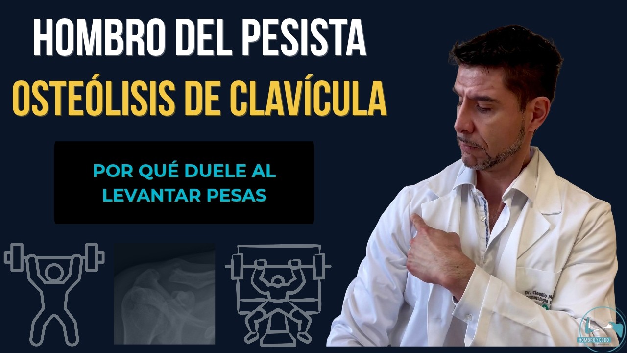 Hombro y osteolisis clav&iacute;cula distal (hombro del pesista): todo lo que debes saber acerca de! ⚙️👨&zwj;⚕️