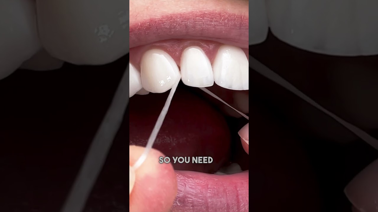 Bleeding Gums? Why You Should Keep Flossing