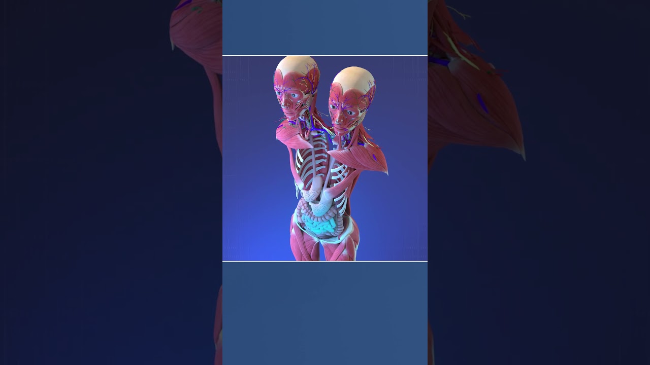 Two Heads, One Body: Anatomy of Conjoined Twins