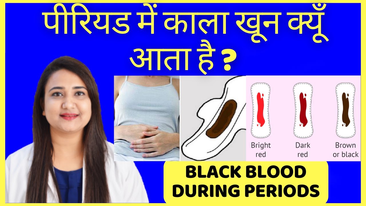 पीरियड में काला खून क्यूँ आता है ? BLACK FLOW DURING PERIODS